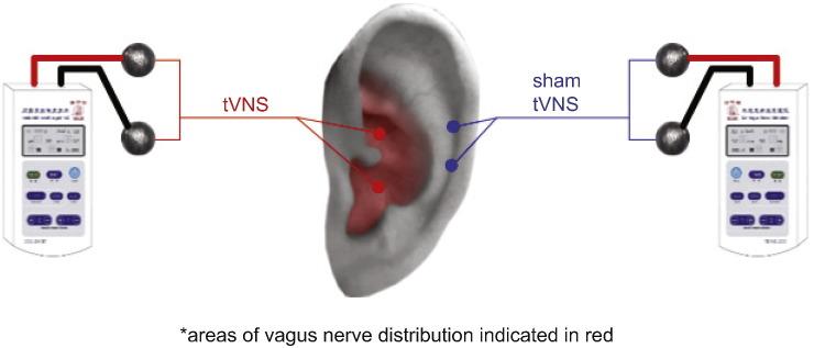 https://cdn.ncbi.nlm.nih.gov/pmc/blobs/c629/5279909/2aa93270a559/gr1.jpg