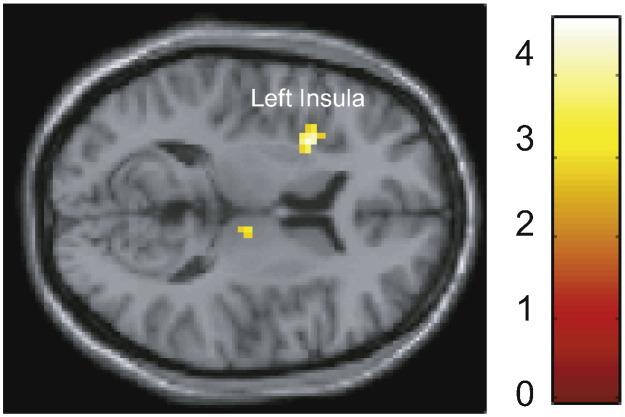 https://cdn.ncbi.nlm.nih.gov/pmc/blobs/c629/5279909/ed3771402efd/gr4.jpg