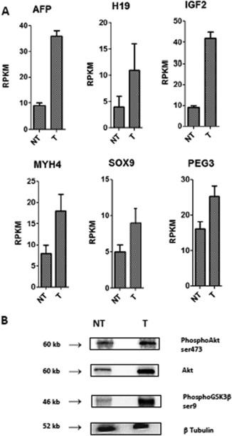 https://cdn.ncbi.nlm.nih.gov/pmc/blobs/c629/5944574/14e5df1088bd/HEP4-2-607-g001.jpg
