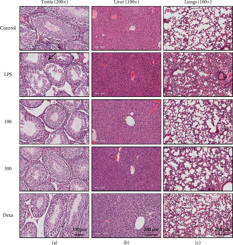 https://cdn.ncbi.nlm.nih.gov/pmc/blobs/c639/9124116/bf158dabf69d/ECAM2022-5783867.007.jpg