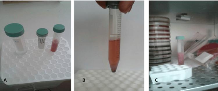 https://cdn.ncbi.nlm.nih.gov/pmc/blobs/c641/11466056/d0382c897110/cureus-0016-00000069085-i02.jpg