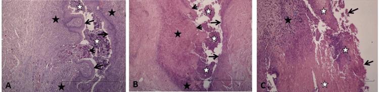 https://cdn.ncbi.nlm.nih.gov/pmc/blobs/c641/11466056/e237893659d7/cureus-0016-00000069085-i03.jpg