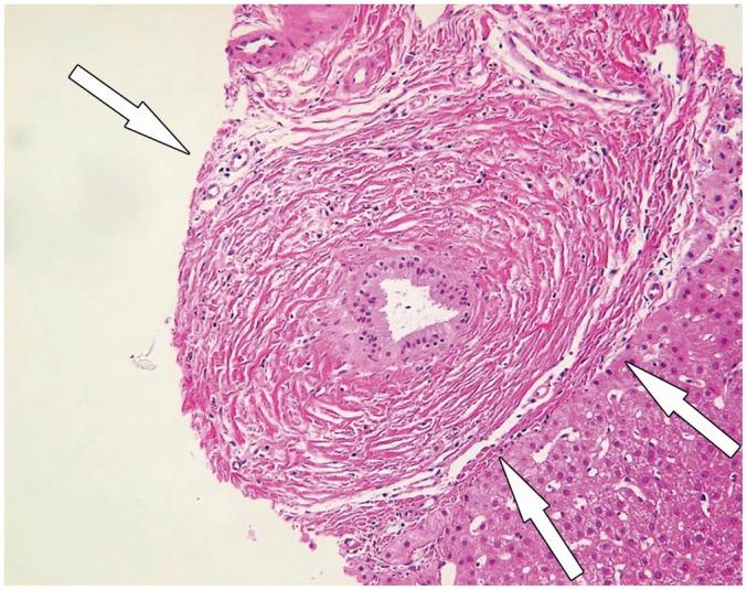 https://cdn.ncbi.nlm.nih.gov/pmc/blobs/c642/4720808/1732481fbbe6/kjr-17-25-g001.jpg