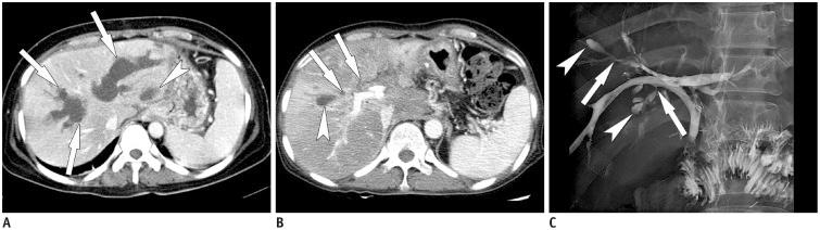 https://cdn.ncbi.nlm.nih.gov/pmc/blobs/c642/4720808/2f035d217164/kjr-17-25-g010.jpg