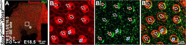 https://cdn.ncbi.nlm.nih.gov/pmc/blobs/c643/5388538/01a9644827cd/elife-23661-fig6-figsupp2.jpg