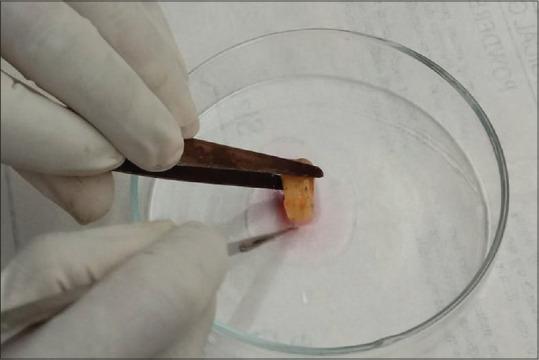 https://cdn.ncbi.nlm.nih.gov/pmc/blobs/c645/10538507/57c7d41b2377/JISP-27-465-g005.jpg
