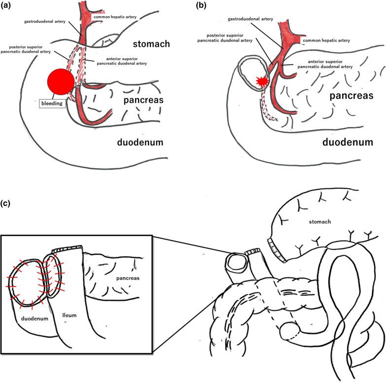 https://cdn.ncbi.nlm.nih.gov/pmc/blobs/c64e/10792133/7fa7d2153779/40792_2024_1816_Fig5_HTML.jpg