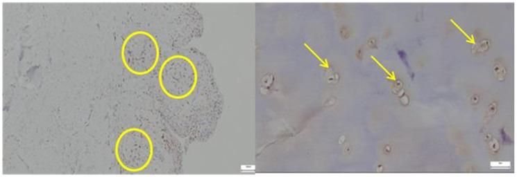 https://cdn.ncbi.nlm.nih.gov/pmc/blobs/c656/12345908/2a5f6fab54f0/diagnostics-15-01932-g010.jpg