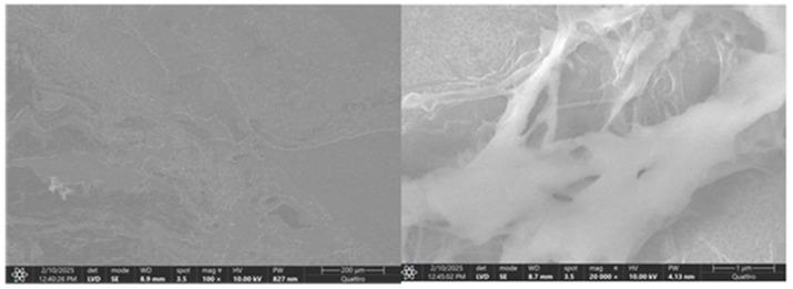 https://cdn.ncbi.nlm.nih.gov/pmc/blobs/c656/12345908/a1600180f153/diagnostics-15-01932-g018.jpg