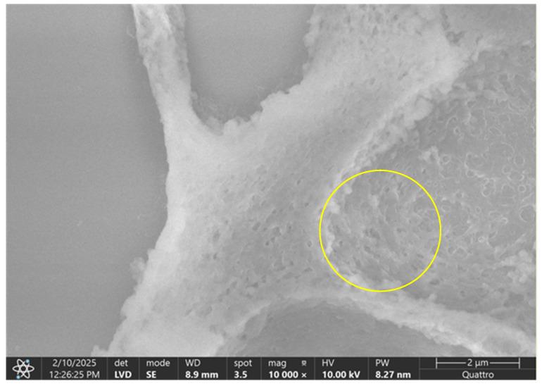 https://cdn.ncbi.nlm.nih.gov/pmc/blobs/c656/12345908/a42c9cad0906/diagnostics-15-01932-g016.jpg