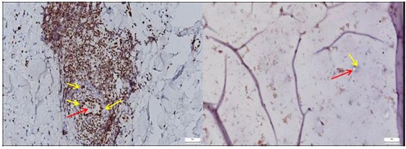 https://cdn.ncbi.nlm.nih.gov/pmc/blobs/c656/12345908/c332226b4064/diagnostics-15-01932-g007.jpg