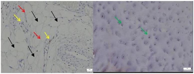 https://cdn.ncbi.nlm.nih.gov/pmc/blobs/c656/12345908/f81a42bc1300/diagnostics-15-01932-g009.jpg