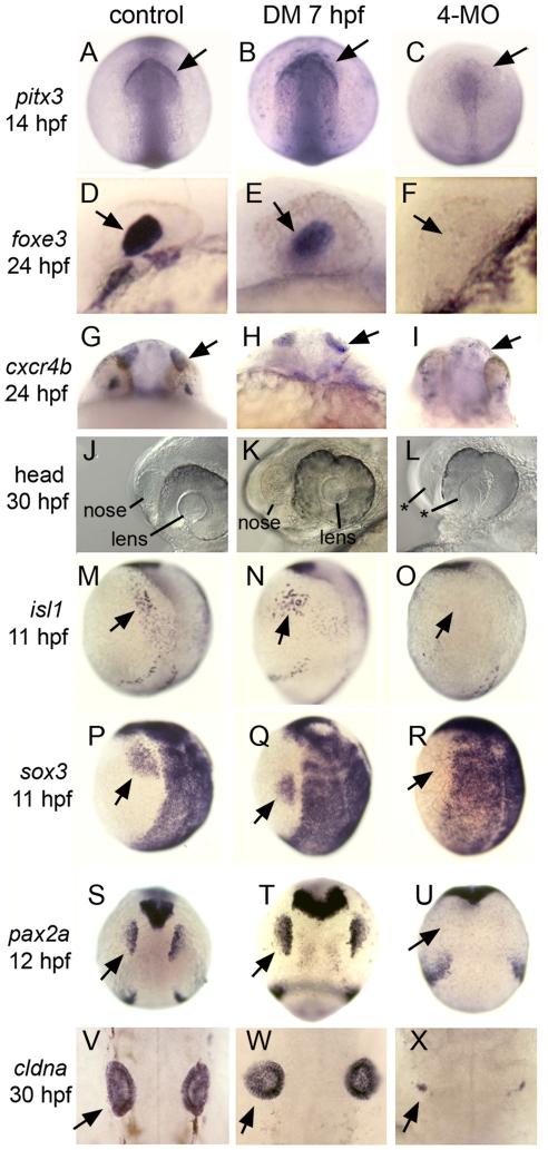 https://cdn.ncbi.nlm.nih.gov/pmc/blobs/c659/2944784/3b1fa34e3262/pgen.1001133.g004.jpg