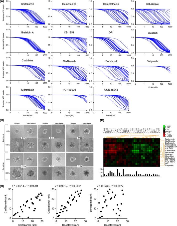 https://cdn.ncbi.nlm.nih.gov/pmc/blobs/c664/6317944/c1476b74941f/CAS-110-345-g004.jpg
