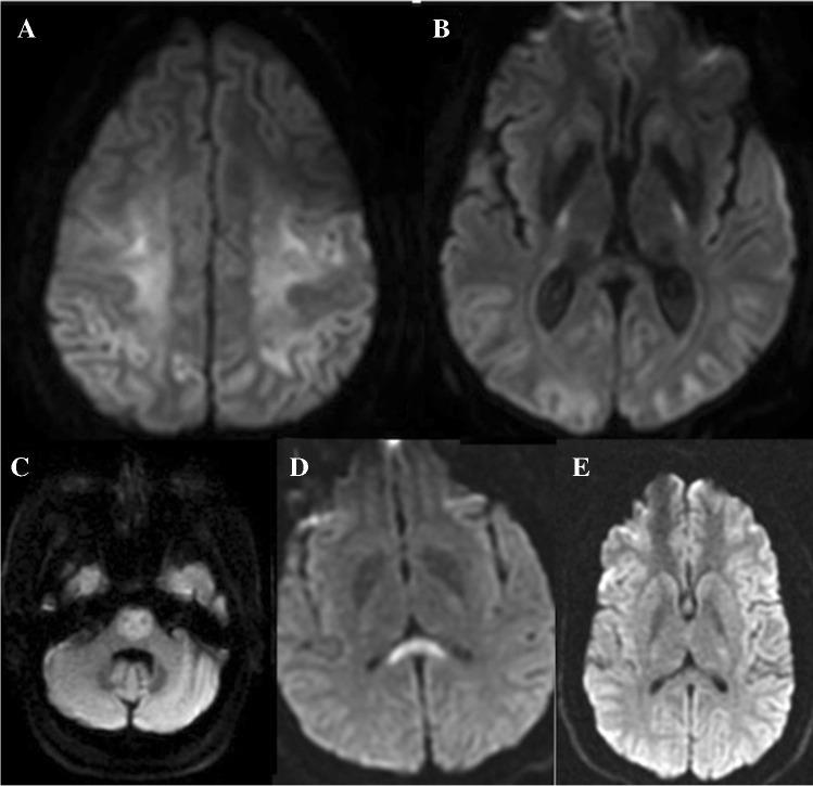 https://cdn.ncbi.nlm.nih.gov/pmc/blobs/c66a/8484843/12cad7085012/234_2021_2819_Fig8_HTML.jpg