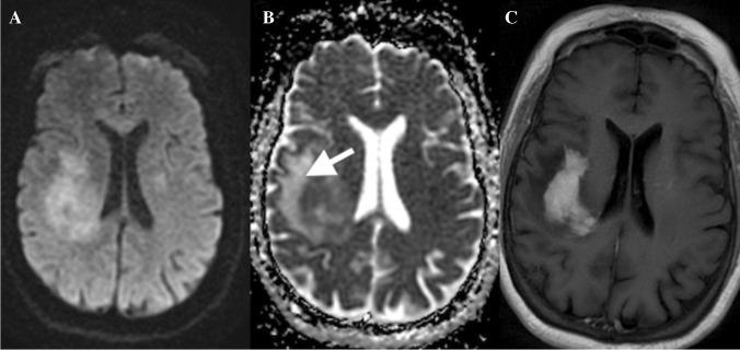 https://cdn.ncbi.nlm.nih.gov/pmc/blobs/c66a/8484843/5a6f2dd6d24b/234_2021_2819_Fig12_HTML.jpg