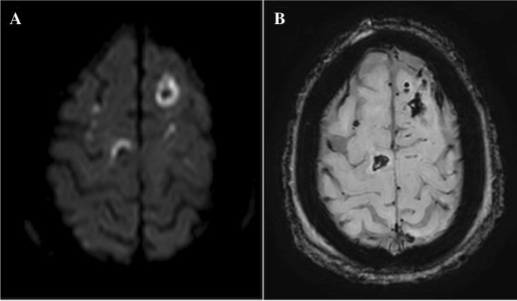 https://cdn.ncbi.nlm.nih.gov/pmc/blobs/c66a/8484843/62630776adaa/234_2021_2819_Fig4_HTML.jpg