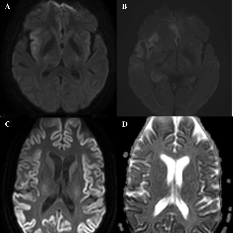 https://cdn.ncbi.nlm.nih.gov/pmc/blobs/c66a/8484843/6e657fa0bff2/234_2021_2819_Fig3_HTML.jpg