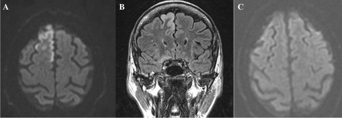 https://cdn.ncbi.nlm.nih.gov/pmc/blobs/c66a/8484843/b6762f36efff/234_2021_2819_Fig9_HTML.jpg