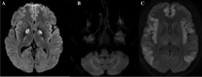 https://cdn.ncbi.nlm.nih.gov/pmc/blobs/c66a/8484843/bd9d470fa3ac/234_2021_2819_Fig6_HTML.jpg