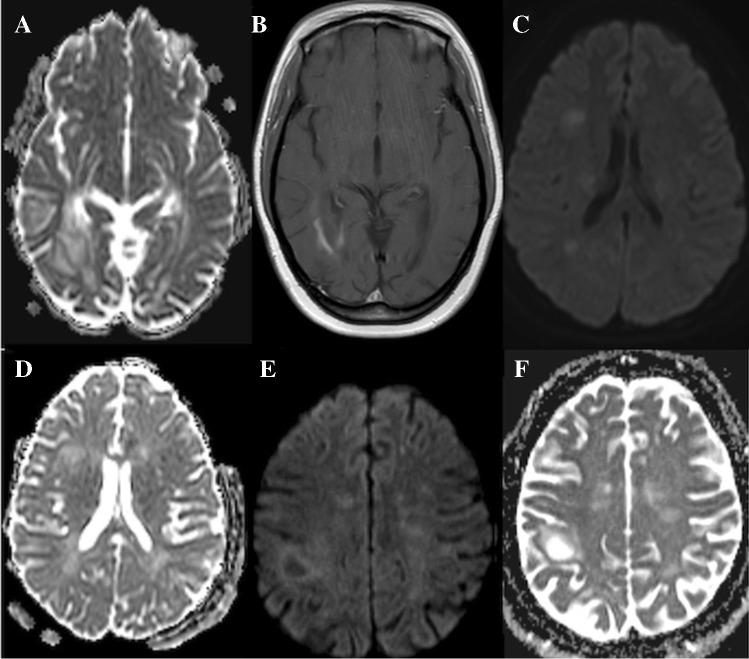 https://cdn.ncbi.nlm.nih.gov/pmc/blobs/c66a/8484843/f9c81f780c89/234_2021_2819_Fig5_HTML.jpg