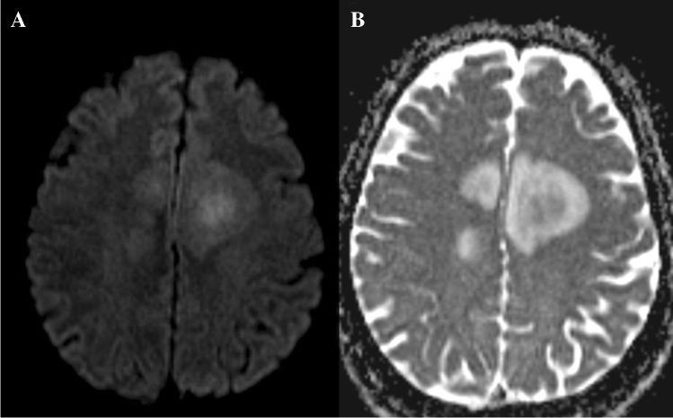 https://cdn.ncbi.nlm.nih.gov/pmc/blobs/c66a/8484843/fed0f76cd307/234_2021_2819_Fig10_HTML.jpg