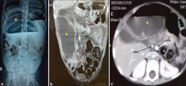 https://cdn.ncbi.nlm.nih.gov/pmc/blobs/c66b/11649044/fde8b43bb003/JIAPS-29-644-g001.jpg