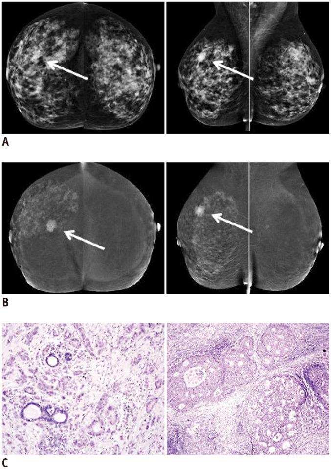 https://cdn.ncbi.nlm.nih.gov/pmc/blobs/c66c/4248623/2541a9ad72f6/kjr-15-689-g002.jpg