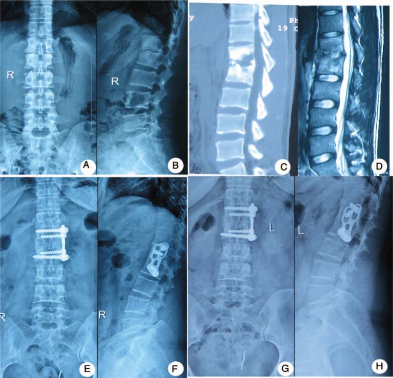 https://cdn.ncbi.nlm.nih.gov/pmc/blobs/c67a/5690773/2dd69e9c7d41/medi-96-e8574-g003.jpg