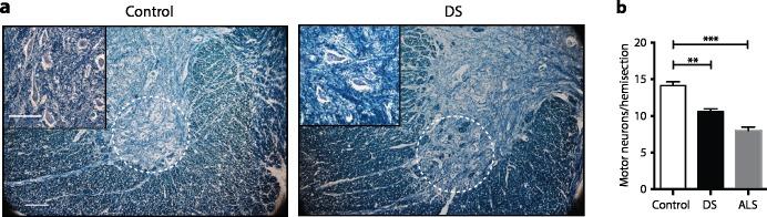 https://cdn.ncbi.nlm.nih.gov/pmc/blobs/c67c/5963810/4f86b988c505/pgen.1007383.g007.jpg