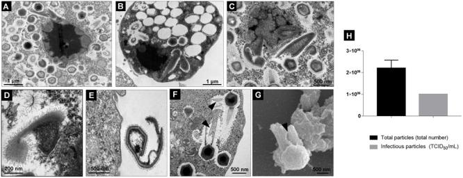 https://cdn.ncbi.nlm.nih.gov/pmc/blobs/c67c/6456662/5bb25a9c9c34/fmicb-10-00671-g007.jpg