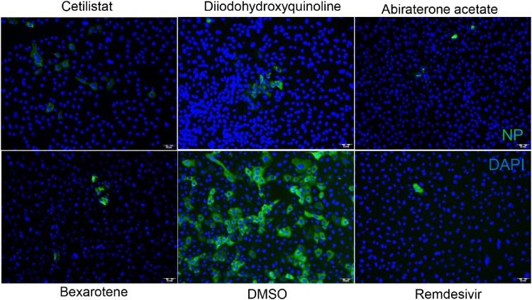 https://cdn.ncbi.nlm.nih.gov/pmc/blobs/c67c/7254006/ab8bac7be152/gr4_lrg.jpg
