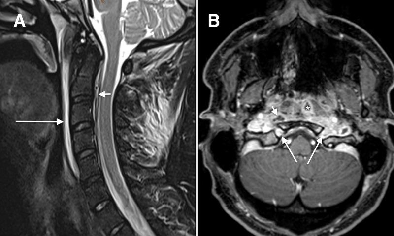 https://cdn.ncbi.nlm.nih.gov/pmc/blobs/c682/9896245/84ac1c7e4943/bcr-2022-253496f02.jpg