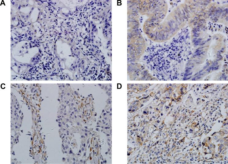 https://cdn.ncbi.nlm.nih.gov/pmc/blobs/c696/4727521/125ad6195596/ott-9-377Fig1.jpg