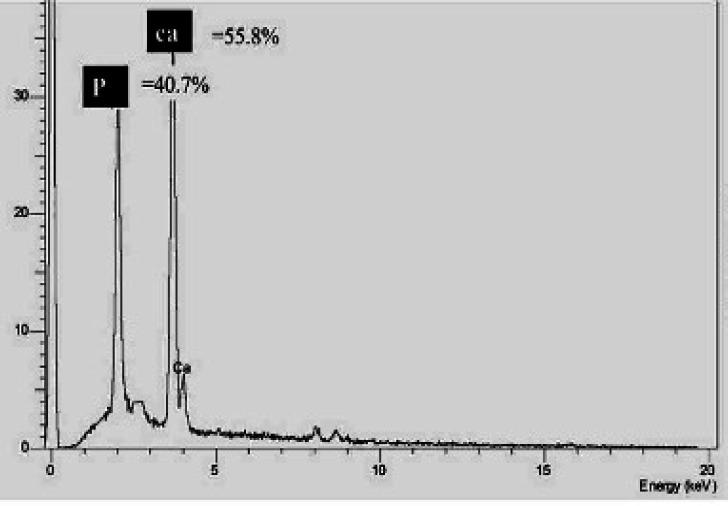 https://cdn.ncbi.nlm.nih.gov/pmc/blobs/c698/9868998/a9e557bd2869/IEJ-17-185-g003.jpg
