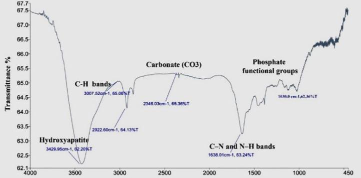 https://cdn.ncbi.nlm.nih.gov/pmc/blobs/c698/9868998/dfad1943e018/IEJ-17-185-g004.jpg