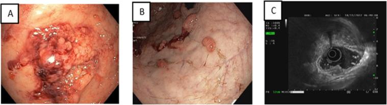 https://cdn.ncbi.nlm.nih.gov/pmc/blobs/c69a/10250828/9bb6259b1685/gr1.jpg