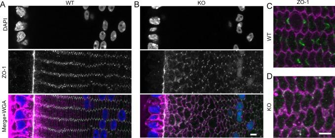 https://cdn.ncbi.nlm.nih.gov/pmc/blobs/c69b/4913802/1425a669b116/i1552-5783-57-7-3039-f04.jpg