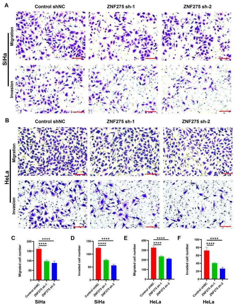 https://cdn.ncbi.nlm.nih.gov/pmc/blobs/c69e/10705782/e09fa461f870/cancers-15-05625-g002.jpg
