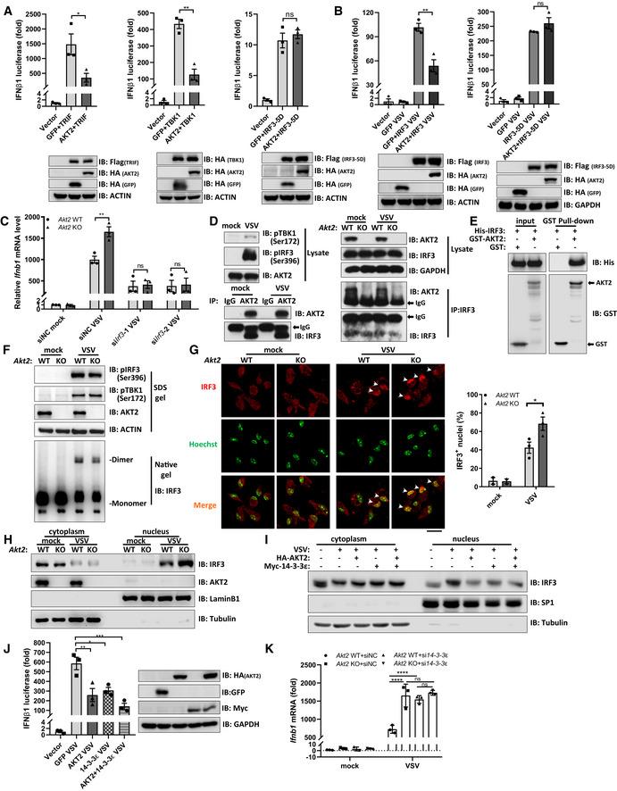 https://cdn.ncbi.nlm.nih.gov/pmc/blobs/c6a1/8922272/56af31d8633b/EMBJ-41-e108016-g003.jpg
