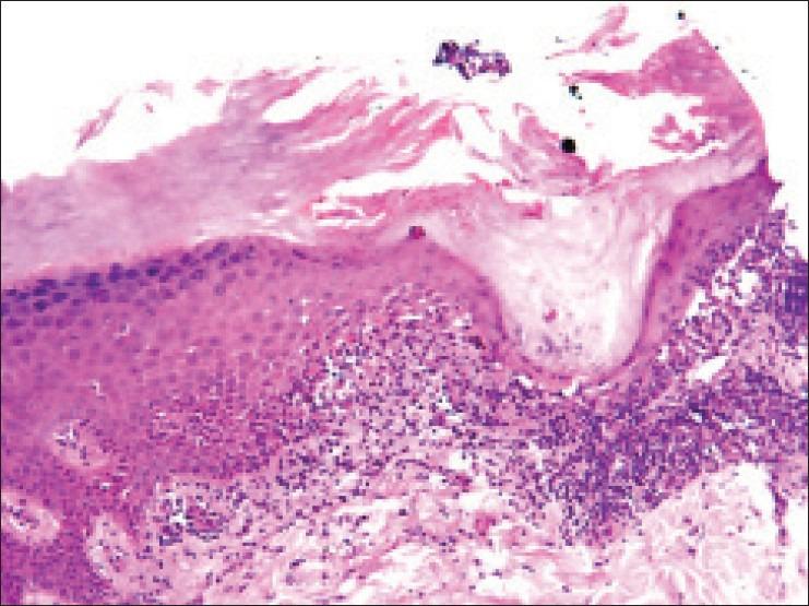 https://cdn.ncbi.nlm.nih.gov/pmc/blobs/c6a5/3853909/ec62dcb334a2/IDOJ-4-350-g003.jpg