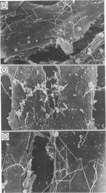 https://cdn.ncbi.nlm.nih.gov/pmc/blobs/c6a6/1011748/16cf11c83c26/genitmed00073-0022-a.jpg