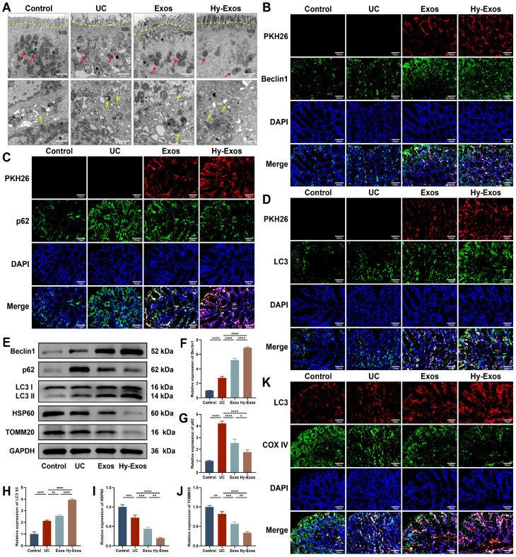 https://cdn.ncbi.nlm.nih.gov/pmc/blobs/c6b4/11303078/09d0bbd71664/thnov14p4278g008.jpg