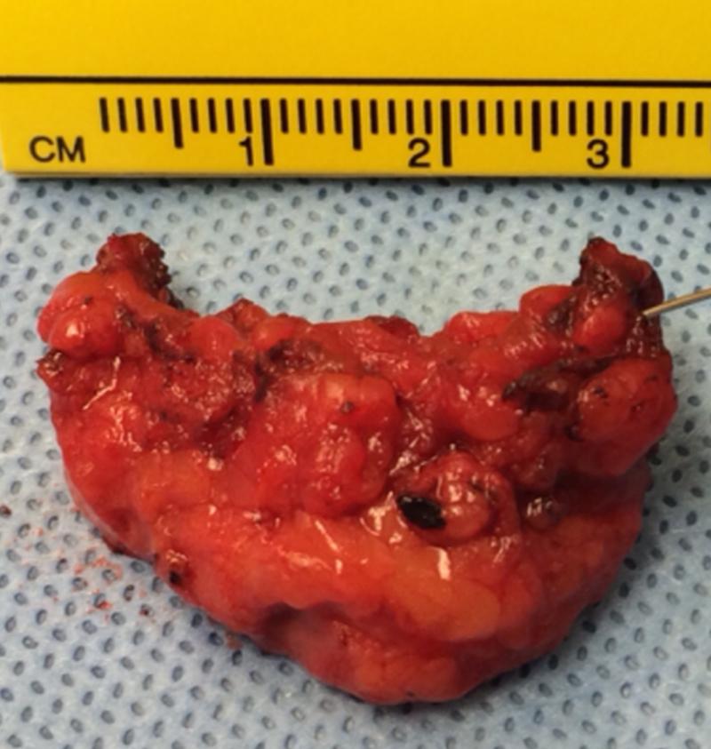 https://cdn.ncbi.nlm.nih.gov/pmc/blobs/c6b4/4818321/0c4ba0e46b49/gr2.jpg