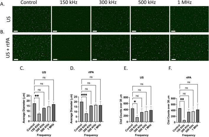 https://cdn.ncbi.nlm.nih.gov/pmc/blobs/c6b8/12256466/9ab10b097995/fbioe-13-1604447-g003.jpg