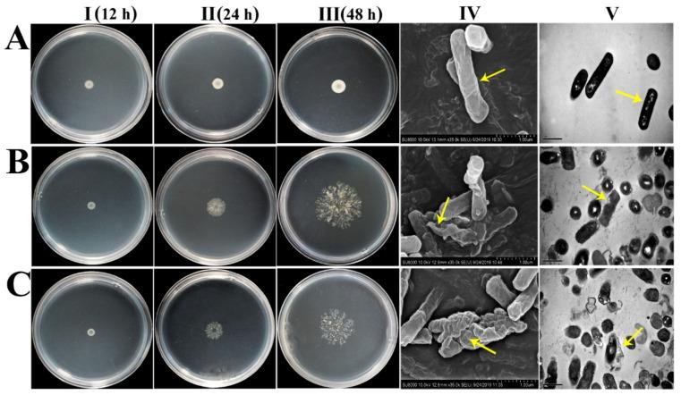 https://cdn.ncbi.nlm.nih.gov/pmc/blobs/c6b9/7698926/3d6d6a223e74/ijms-21-08722-g001.jpg