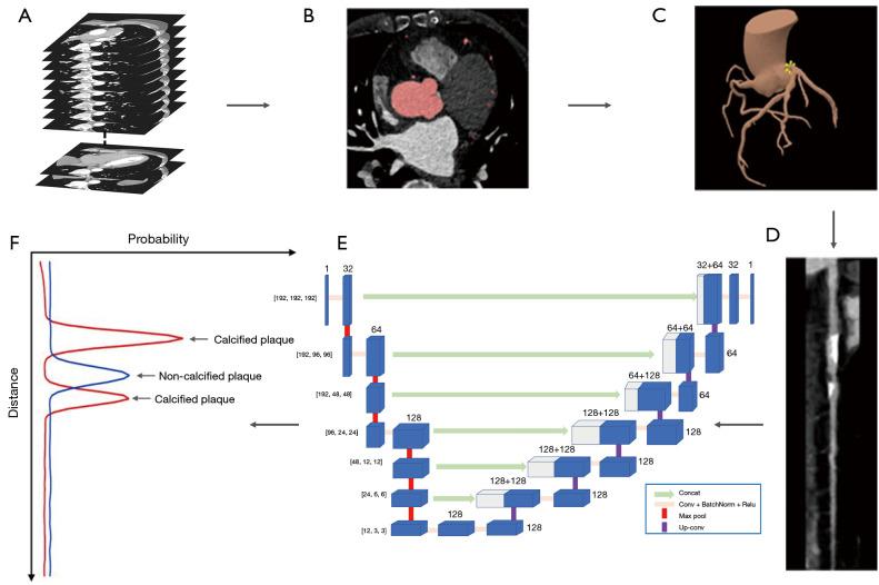 https://cdn.ncbi.nlm.nih.gov/pmc/blobs/c6bd/11151262/f2e30c8e88f8/qims-14-06-3837-f4.jpg
