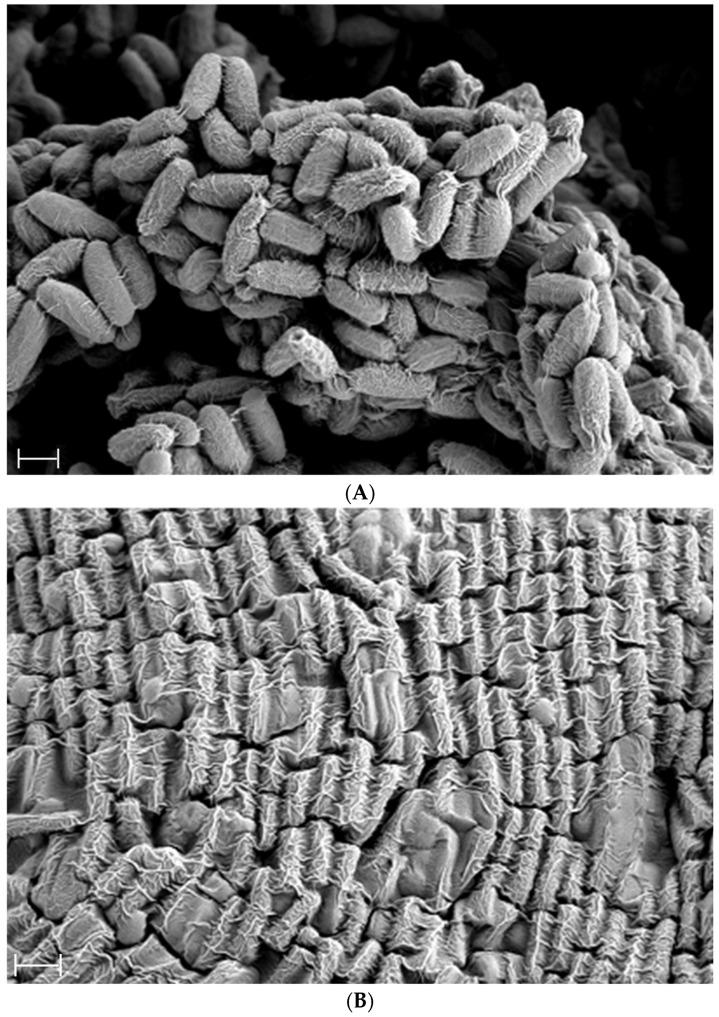 https://cdn.ncbi.nlm.nih.gov/pmc/blobs/c6cc/12347200/35c6f8d11974/ijms-26-07615-g002.jpg