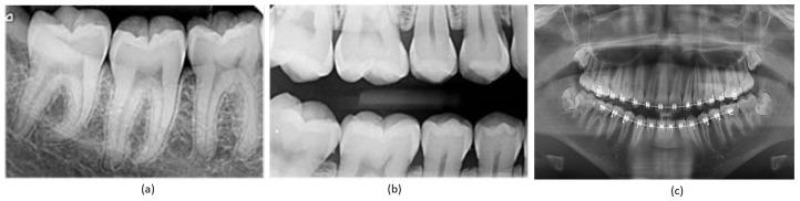 https://cdn.ncbi.nlm.nih.gov/pmc/blobs/c6e0/10376801/05a02cf5c1e4/bioengineering-10-00843-g001.jpg