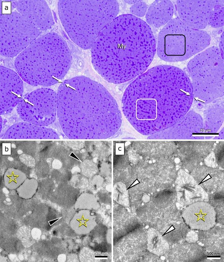 https://cdn.ncbi.nlm.nih.gov/pmc/blobs/c6e1/10449970/23358ba27758/439_2023_2571_Fig1_HTML.jpg